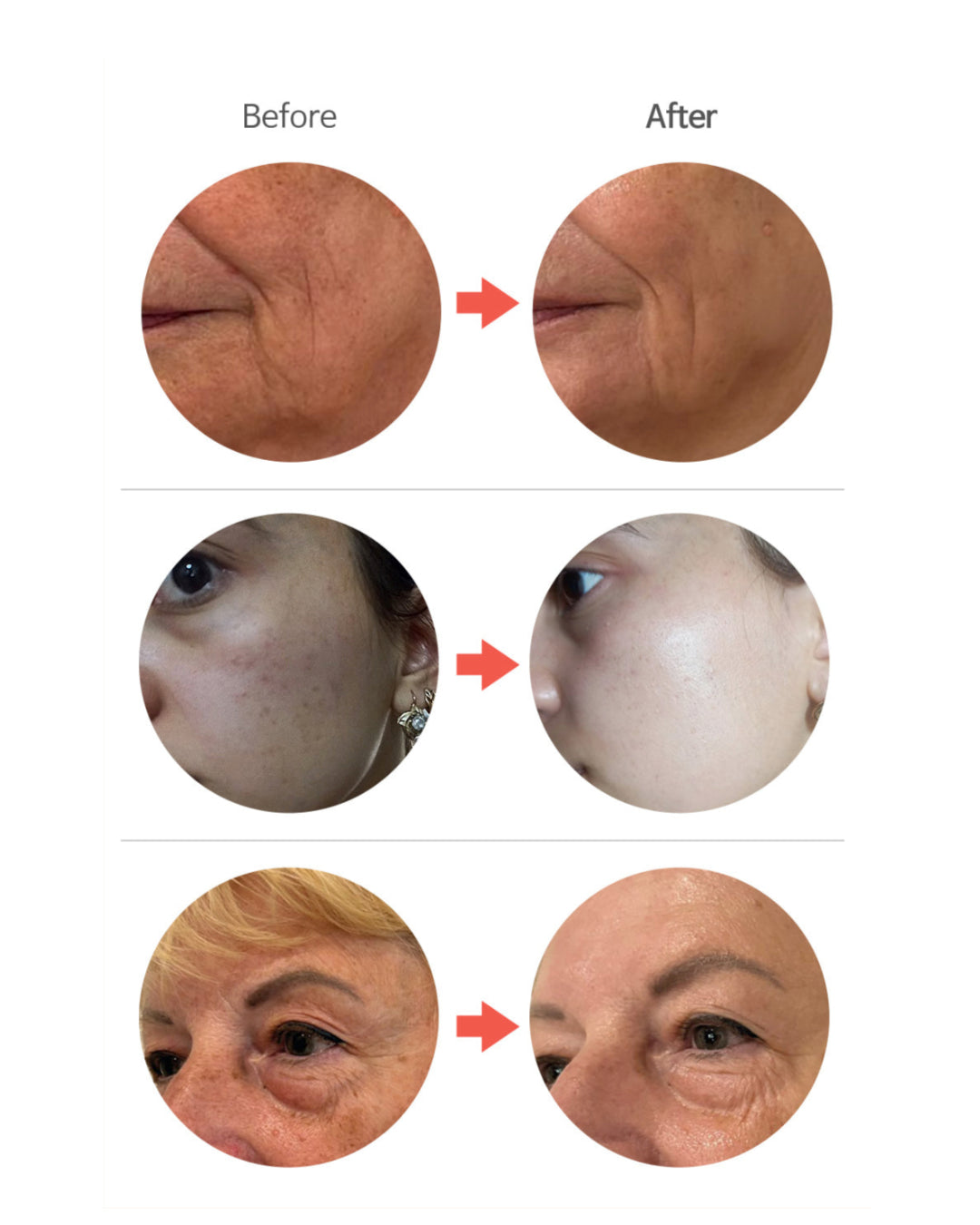 Bio-Activating PDRN Cream 100g