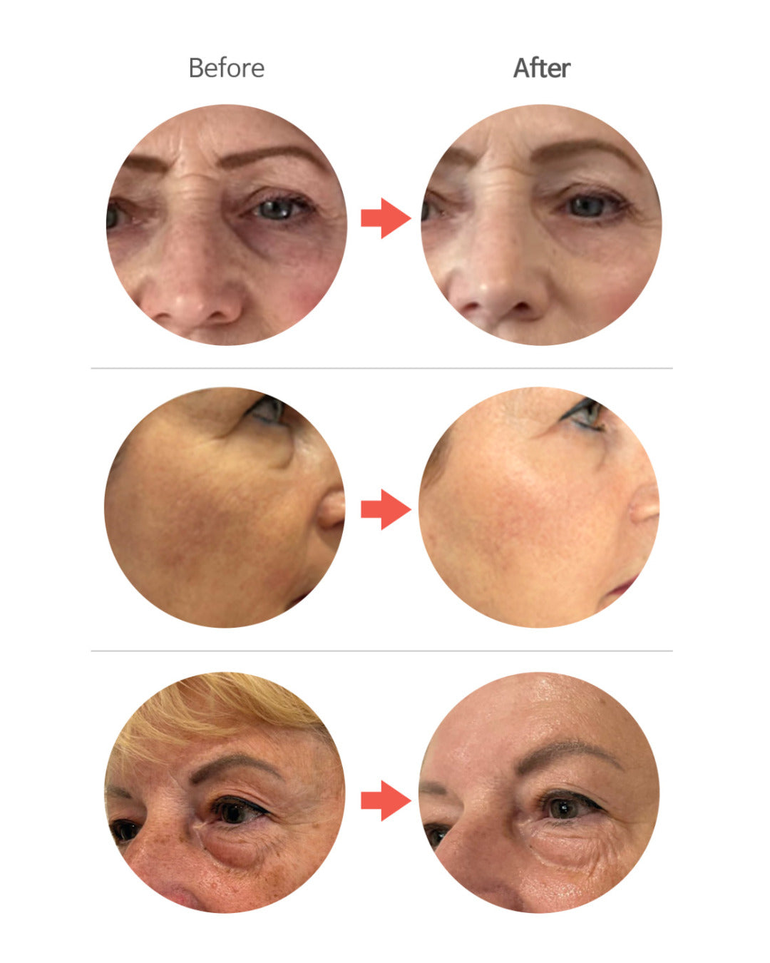 Dermaline Bio Activing PDRN Eye Patch 1.4g x 60ea
