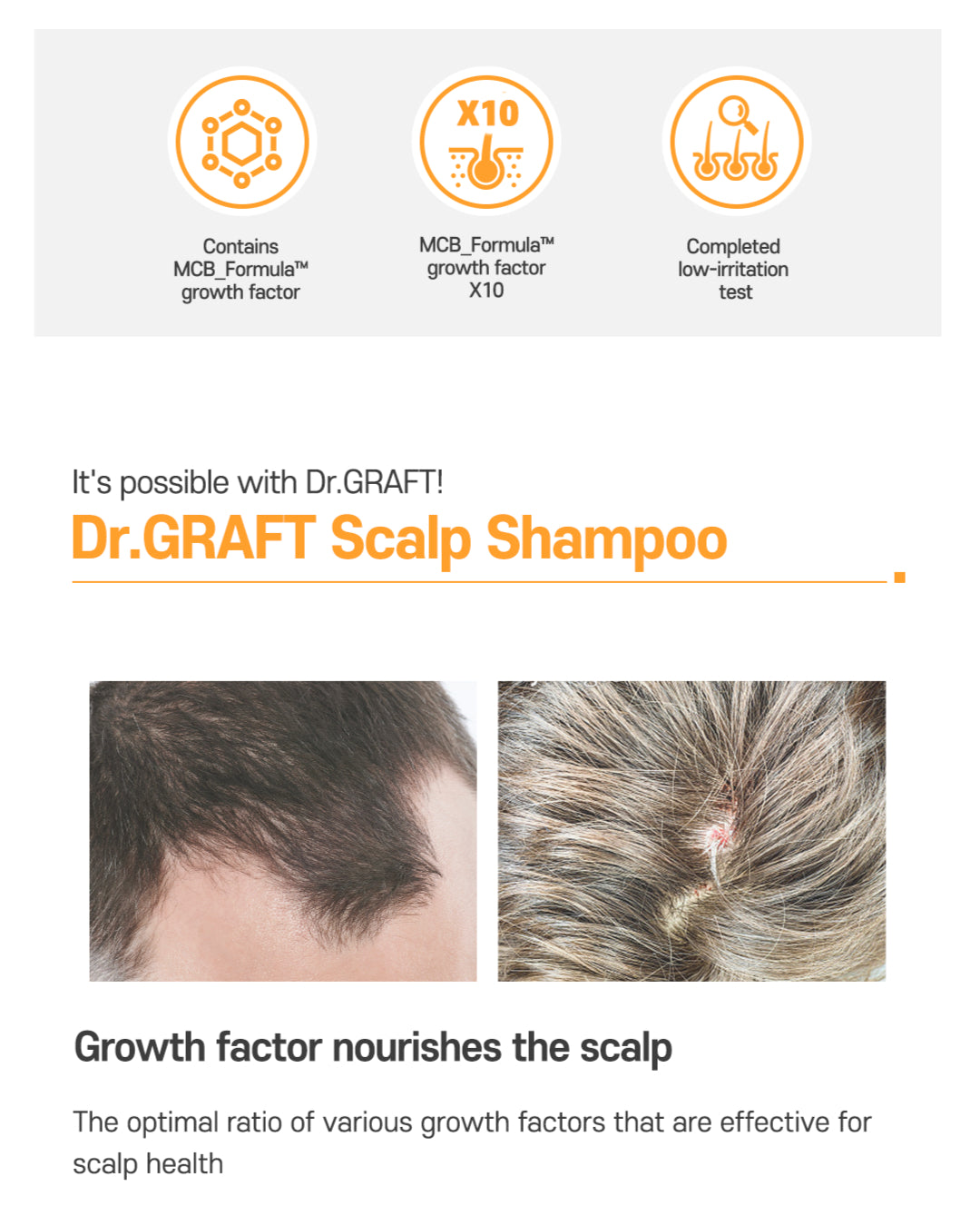 Dr.GRAFT Scalp Tonic Spray 100ml — 10x Concentrated Growth Factor Scalp Tonic
